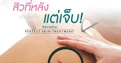 อีกหนึ่งโปรแกรมที่ลูกค้าไว้วางใจ Perfect Skin Treatment (PST)