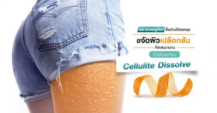 ลาขาดผิวเปลือกส้ม ใส่ขาสั้นแค่ไหนก็มั่นใจ เพราะมี Cellulite Dissolve